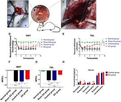 Pain Relief Dependent on IL-17–CD4+ T Cell–β-Endorphin Axis in Rat Model of Brachial Plexus Root Avulsion After Electroacupuncture Therapy
